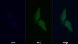 Invitrogen PYGM Polyclonal Antibody 200 &mu;L; Unconjugated:Antibodies,