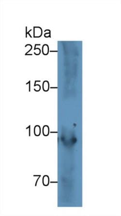 Invitrogen PYGM Polyclonal Antibody 200 &mu;L; Unconjugated:Antibodies,