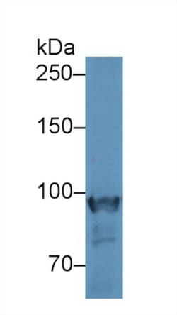 Invitrogen PYGM Polyclonal Antibody 200 &mu;L; Unconjugated:Antibodies,