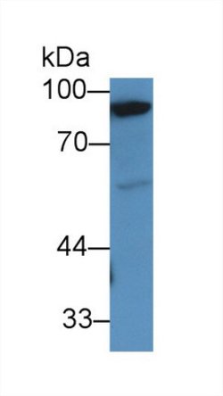 Invitrogen PYGM Polyclonal Antibody 200 &mu;L; Unconjugated:Antibodies,
