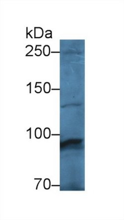 Invitrogen PYGM Polyclonal Antibody 200 &mu;L; Unconjugated:Antibodies,