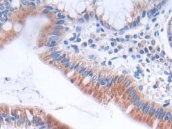 Invitrogen GLTP Polyclonal Antibody:Antibodies:Primary Antibodies