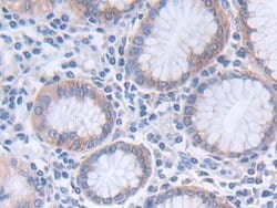 Invitrogen GLTP Polyclonal Antibody:Antibodies:Primary Antibodies