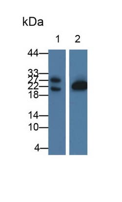 Invitrogen GLTP Polyclonal Antibody:Antibodies:Primary Antibodies