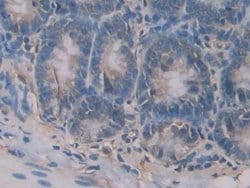 Invitrogen CD42a Polyclonal Antibody 200 &mu;L; Unconjugated:Antibodies,