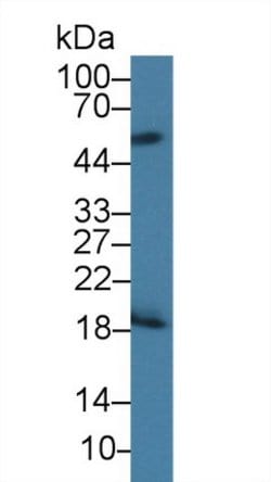 Invitrogen CD42a Polyclonal Antibody 200 &mu;L; Unconjugated:Antibodies,