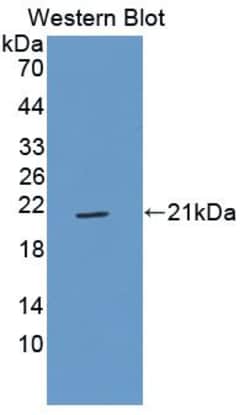 Invitrogen CD42a Polyclonal Antibody:Antibodies:Primary Antibodies