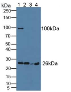 Invitrogen Grancalcin Polyclonal Antibody 200 &mu;L; Unconjugated:Antibodies,