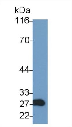 Invitrogen Granzyme A Polyclonal Antibody:Antibodies:Primary Antibodies