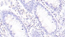 Invitrogen Granzyme M Polyclonal Antibody 20 &mu;L; Unconjugated:Antibodies,
