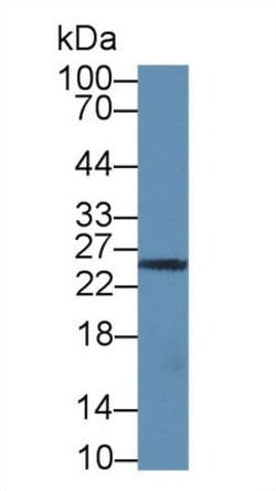 Invitrogen Granzyme M Polyclonal Antibody 20 &mu;L; Unconjugated:Antibodies,