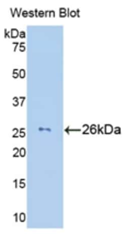 Invitrogen Granzyme M Polyclonal Antibody 20 &mu;L; Unconjugated:Antibodies,