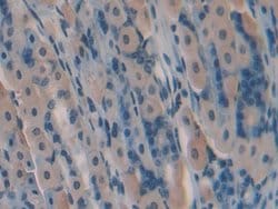 Invitrogen GREM1 Polyclonal Antibody 200 &mu;L; Unconjugated:Antibodies,
