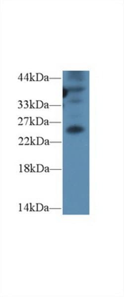 Invitrogen GREM1 Polyclonal Antibody 200 &mu;L; Unconjugated:Antibodies,