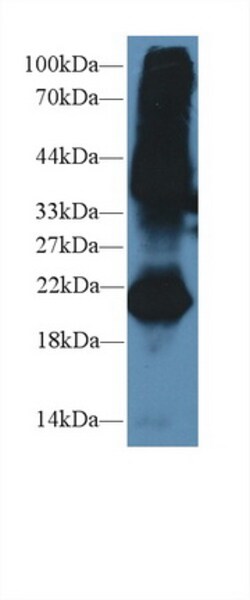 Invitrogen GREM1 Polyclonal Antibody 20 &mu;L; Unconjugated:Antibodies,