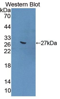 Invitrogen GREM1 Polyclonal Antibody 200 &mu;L; Unconjugated:Antibodies,