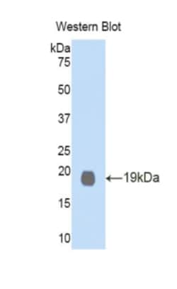 Invitrogen GDF1 Polyclonal Antibody 20 &mu;L; Unconjugated:Antibodies,