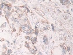 Invitrogen GRB10 Polyclonal Antibody:Antibodies:Primary Antibodies