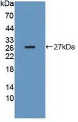 Invitrogen GRB10 Polyclonal Antibody:Antibodies:Primary Antibodies