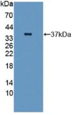 Invitrogen GBP4 Polyclonal Antibody 20 &mu;L | Buy Online | Invitrogen&trade; | Fisher Scientific