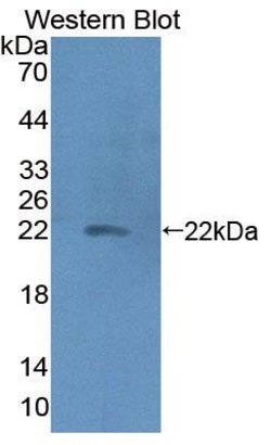 Invitrogen Haptoglobin Polyclonal Antibody 200 &mu;L; Unconjugated:Antibodies,