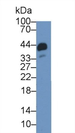 Invitrogen Haptoglobin Polyclonal Antibody 200 &mu;L; Unconjugated:Antibodies,