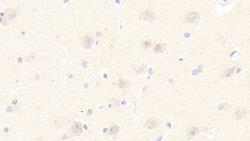 Invitrogen DNAJC4 Polyclonal Antibody:Antibodies:Primary Antibodies
