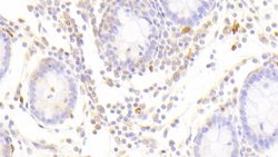 Invitrogen DNAJC4 Polyclonal Antibody:Antibodies:Primary Antibodies