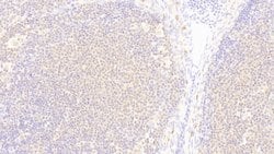 Invitrogen DNAJC4 Polyclonal Antibody:Antibodies:Primary Antibodies