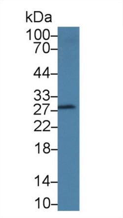 Invitrogen DNAJC4 Polyclonal Antibody:Antibodies:Primary Antibodies