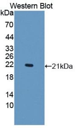 Invitrogen DNAJC4 Polyclonal Antibody:Antibodies:Primary Antibodies