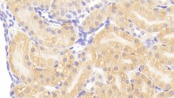 Invitrogen HSPBP1 Polyclonal Antibody:Antibodies:Primary Antibodies