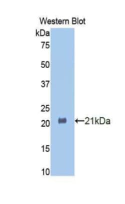 Invitrogen HSPBP1 Polyclonal Antibody:Antibodies:Primary Antibodies