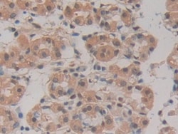 Invitrogen HSPA1A Polyclonal Antibody 20 &mu;L; Unconjugated:Antibodies,