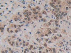 Invitrogen HSPA1A Polyclonal Antibody 20 &mu;L; Unconjugated:Antibodies,