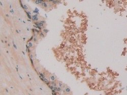 Invitrogen HSPA1A Polyclonal Antibody 20 &mu;L; Unconjugated:Antibodies,