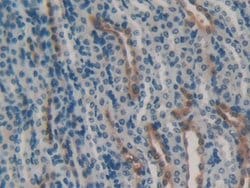 Invitrogen HSPA1B Polyclonal Antibody:Antibodies:Primary Antibodies