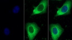Invitrogen HSP27 Polyclonal Antibody:Antibodies:Primary Antibodies