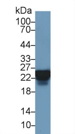 Invitrogen HSP27 Polyclonal Antibody:Antibodies:Primary Antibodies