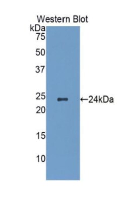 Invitrogen HSP27 Polyclonal Antibody:Antibodies:Primary Antibodies