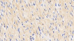 Invitrogen HSP60 Polyclonal Antibody 200 &mu;L | Buy Online | Invitrogen&trade; | Fisher Scientific