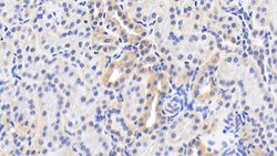 Invitrogen HSP60 Polyclonal Antibody 200 &mu;L | Buy Online | Invitrogen&trade; | Fisher Scientific