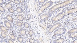 Invitrogen HSP60 Polyclonal Antibody 200 &mu;L | Buy Online | Invitrogen&trade; | Fisher Scientific