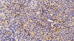 Invitrogen HSP60 Polyclonal Antibody 200 &mu;L | Buy Online | Invitrogen&trade; | Fisher Scientific