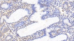 Invitrogen HSP60 Polyclonal Antibody 200 &mu;L | Buy Online | Invitrogen&trade; | Fisher Scientific