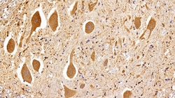 Invitrogen HSP60 Polyclonal Antibody 200 &mu;L | Buy Online | Invitrogen&trade; | Fisher Scientific