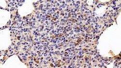 Invitrogen HSP60 Polyclonal Antibody 200 &mu;L | Buy Online | Invitrogen&trade; | Fisher Scientific