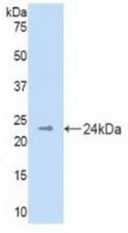 Invitrogen DHH Polyclonal Antibody 200 &mu;L; Unconjugated:Antibodies,