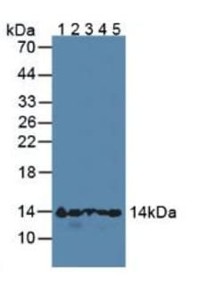Invitrogen Hemoglobin alpha-1 Polyclonal Antibody 20 &mu;L; Unconjugated:Antibodies,