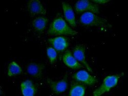 Invitrogen HBD Polyclonal Antibody 20 &mu;L; Unconjugated:Antibodies, Polyclonal